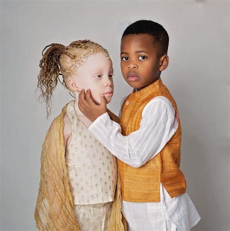 Photographer Gives Birth To Twins One Dark Skinned And One Albino I Think They Re Beautiful