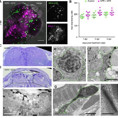 Neutrophils Are Not Affected By Cell Ablation In The Brain A