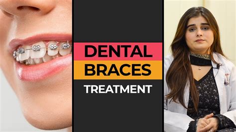 Teeth Braces Treatment In Karachi Hash Clinics Youtube