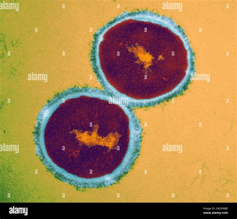 Streptococcus Pyogenes Bacteria Transmission Electron Micrograph Tem