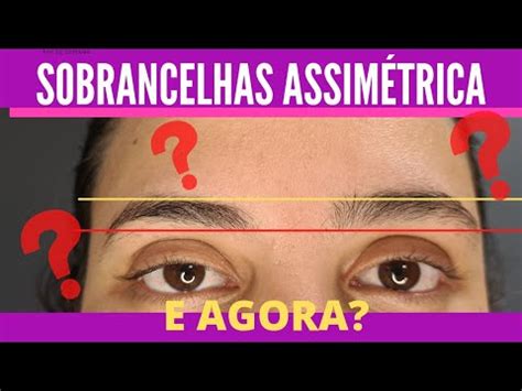 SOBRANCELHAS ASSIMÉTRICAS COMO RESOLVER YouTube