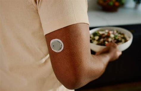 Dexcom Submits New Sensor To Fda Expects Summer Launch