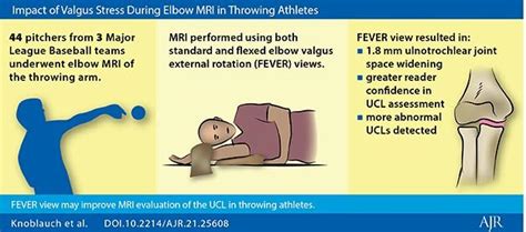Impact Of Valgus Stress During Image Eurekalert Science News Releases