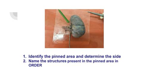 Abdomen Anatomy Spotters Revision For First Mbbspptx