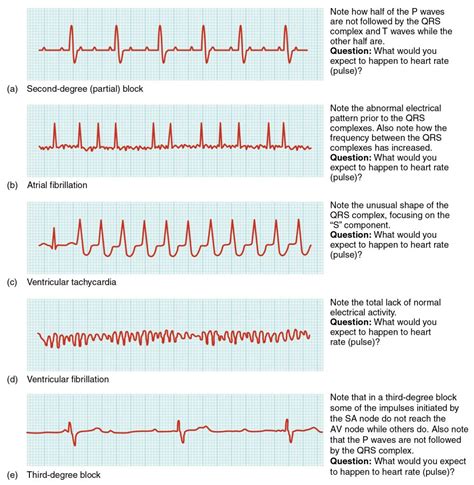 19.2 Cardiac Muscle and Electrical Activity – Anatomy & Physiology