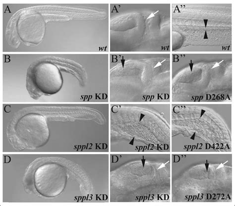 Loss Of Function Phenotypes Of Spp And Sppl In Zebrafish Uninjected