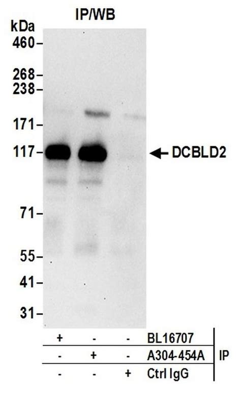 Dcbld2 Polyclonal Antibody A304 454a