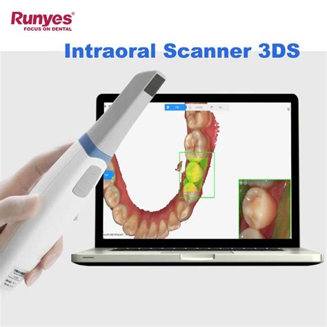 Runyes D Intraoral Digital Dental Impress O Scanner Intraoral Imagem