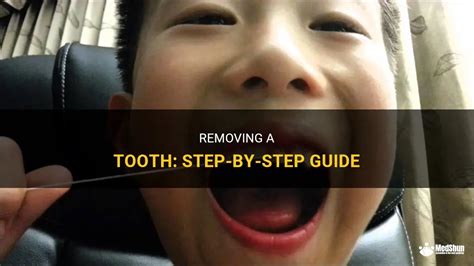 Removing A Tooth Step By Step Guide Medshun