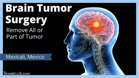 Brain Tumor Surgery Remove All Or Part Of Tumor Trambellir