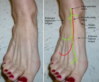 Deep Peroneal Nerve Block