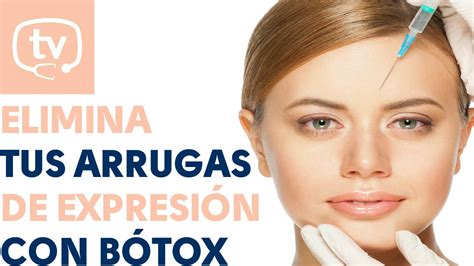 Eliminar las arrugas de expresión con bótox todo lo que debes saber