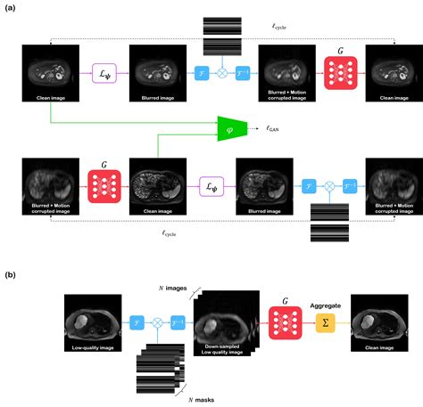 Simultaneous Super Resolution And Motion Artifact Removal In Diffusion