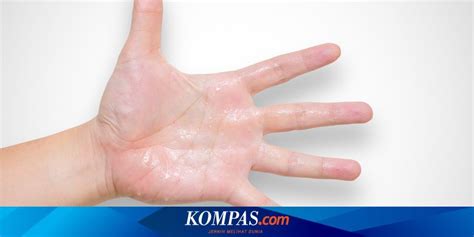 Penyebab Telapak Tangan Dan Kaki Berkeringat Serta Cara Mengatasinya