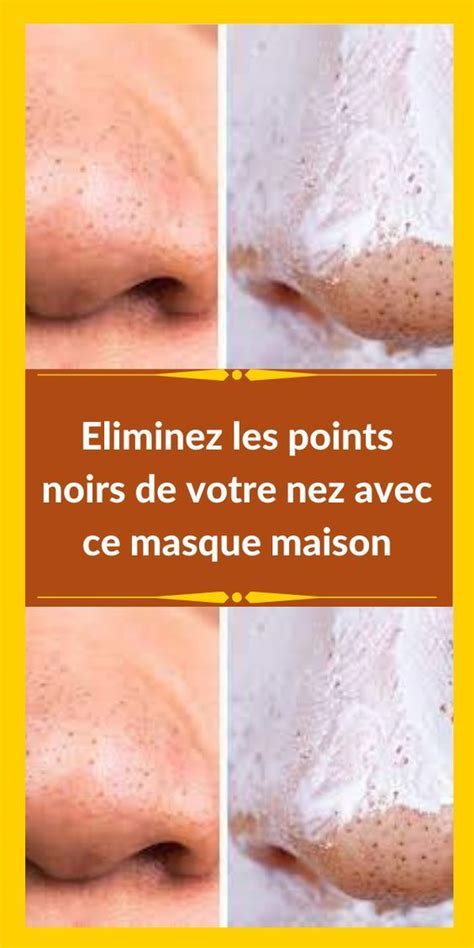 Eliminez Les Points Noirs De Votre Nez Avec Ce Masque Maison Monmag