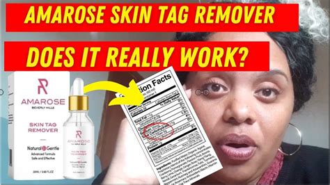 Amarose Skin Tag Remover Review Be Careful Does It Work Amarose