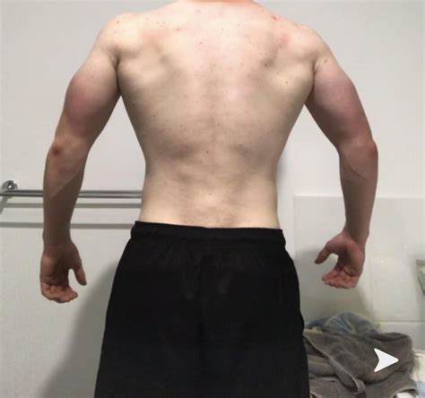 Do I Have High Or Low Lat Insertions R Bodybuildingpics