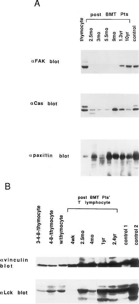 Figure From Altered Tyrosine Phosphorylation Via The Very Late