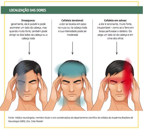 Diferentes Tipos De Dor De Cabeça Sintomas E Suas Causas Tipos Mobile