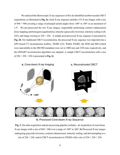 Robust Single View Cone Beam X Ray Pose Estimation With Neural Tuned