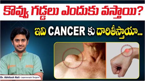 lipoma  telugu  lipoma turn