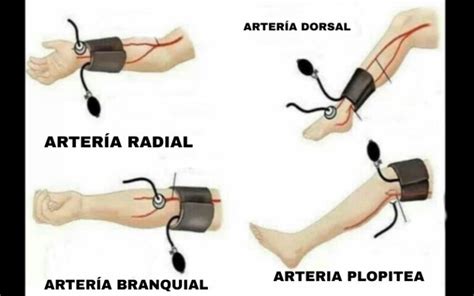 Técnicas De Toma De Presión Arterial Enfermería