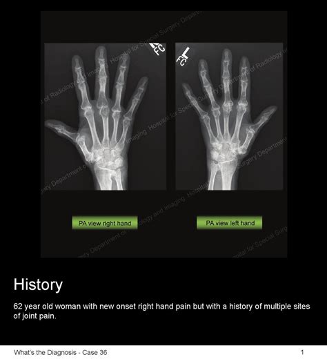 Hss Whats The Diagnosis Case 36 By Hospital For Special Surgery Issuu