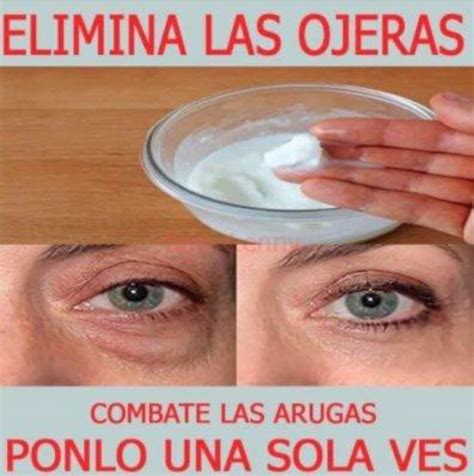 Cómo eliminar las ojeras en 20 minutos con bicarbonato de sodio