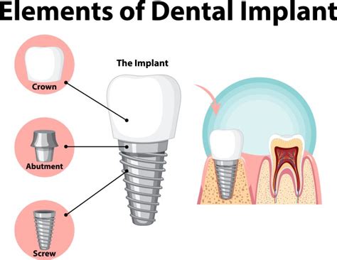 Teeth Maquette Structural Elements Of Dental Vector Image