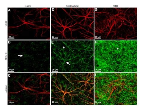 Retinal Macroglia In The Mouse Retina Retinal Whole Mount Double