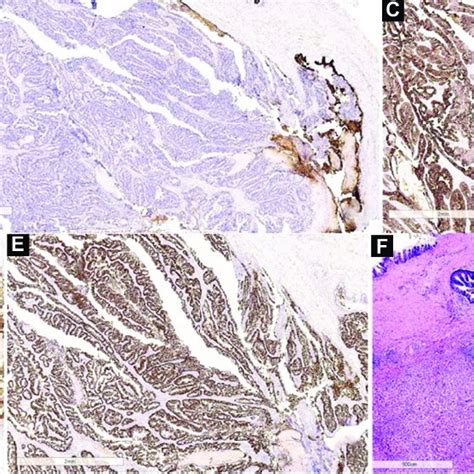 Estudio Inmunohistoqu Mico A Tinci N De Hematoxilina Eosina