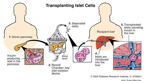 Insulin Production In Pancreas - Insulin Choices