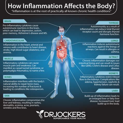 5 Ways To Reduce Inflammation Quickly - DrJockers.com