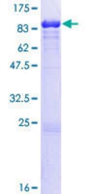 Recombinant Human Lamin B Gst N Term Protein H P Novus