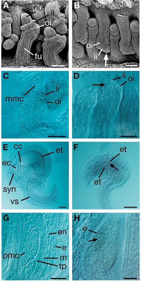 Figure 1 From Molecular Analysis Of Nozzle A Gene Involved In Pattern