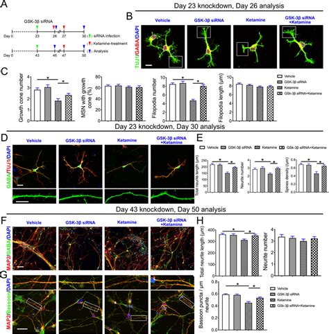 Downregulation of GSK-3β alleviates the effect of ketamine on ...