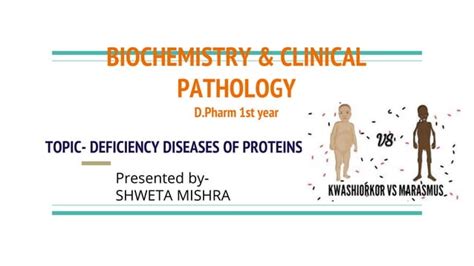 Deficiency Diseases Of Proteins Kwashiorkor Marasmus Ppt