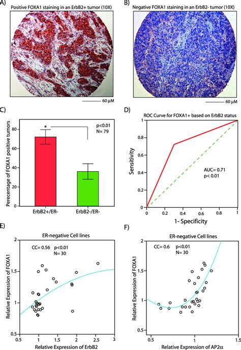 The Association Between Foxa And Erbb Expression In Er Negative