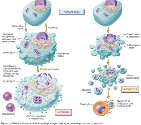 Cell Injury Emedicodiary