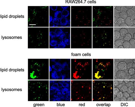 Colocalization Experiments In Raw Cells And Foam Cells Cells Were