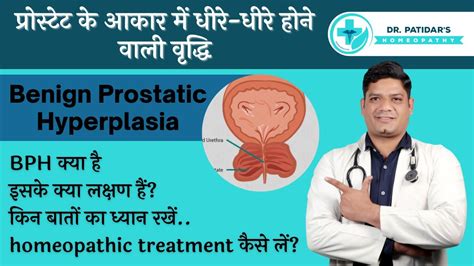 What Is Benign Prostatic Hyperplasia Symptoms Causes Homeopathic