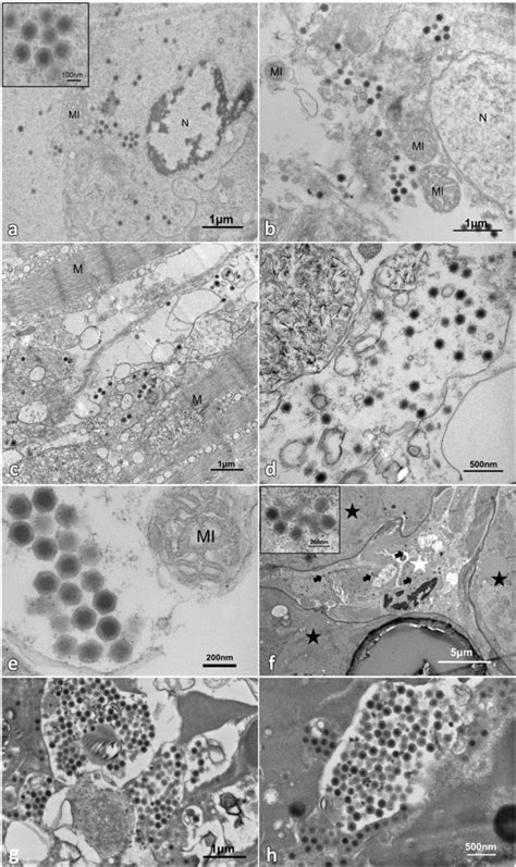 Transmission Electron Microscopy Tem Of Naturally Infected L