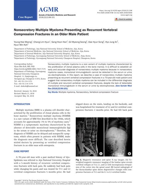 PDF Nonsecretory Multiple Myeloma Presenting As Recurrent Vertebral