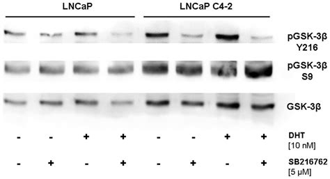 SB216763 inhibits phosphorylation of GSK 3β at tyrosine 216 LNCaP