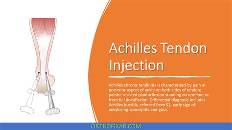 Midpoint Achilles Tendonitis