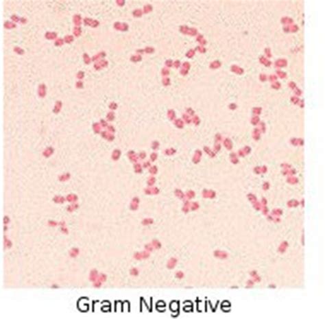 Lab 5 Gram Stain Type Of Differential Stain Flashcards Quizlet