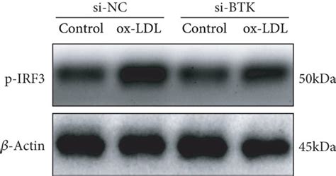 Btk Knockdown Suppressed The Ox Ldl Induced Nk κb Activation And