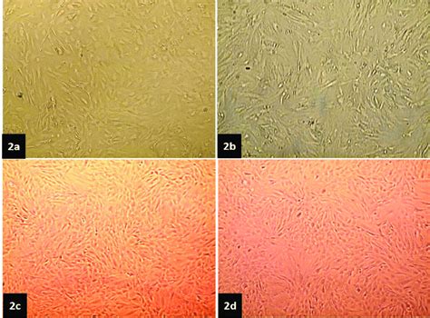 Photomicrographs Of Cultured Adipose Tissue Derived Mesenchymal Stem