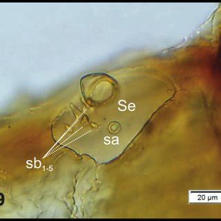 Graptus Triguttatus Triguttatus Mature Larva Clypeus Labrum And