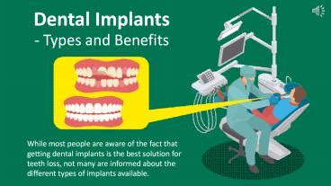 Ppt Dental Implants Types And Benefits Powerpoint Presentation